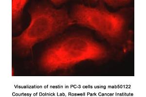 Image no. 1 for anti-Nestin (NES) (AA 1464-1614) antibody (ABIN363276) (Nestin antibody  (AA 1464-1614))