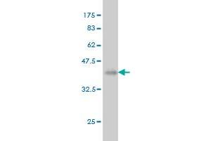 Western Blot detection against Immunogen (36. (MAP3K4 antibody  (AA 1201-1300))