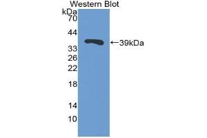 Western blot analysis of the recombinant protein. (TFF3 antibody  (AA 22-80))