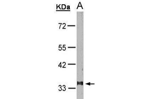 Leukotriene B4 Receptor/BLT antibody