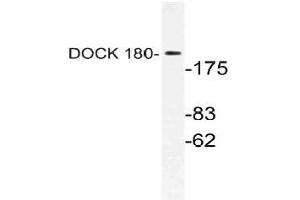 Western blot (WB) analysis of DOCK 180 antibody in extracts from HUVEC cells. (DOCK1 antibody)