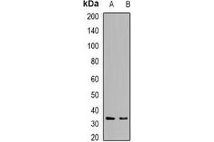 Western blot analysis of DCK expression in Raji (A), HepG2 (B) whole cell lysates. (DCK antibody)