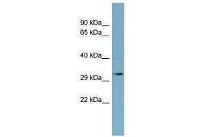 MGC4172 antibody used at 1 ug/ml to detect target protein. (MGC4172 (Middle Region) antibody)