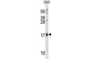 Western Blotting (WB) image for anti-ISG15 Ubiquitin-Like Modifier (ISG15) antibody (ABIN2996231) (ISG15 antibody)