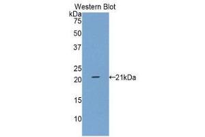 Western Blotting (WB) image for anti-Neuroglobin (NGB) antibody (ABIN1859999) (Neuroglobin antibody)