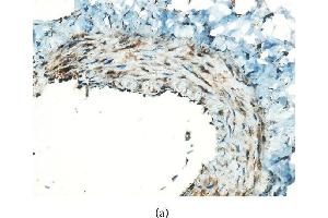 Immunohistochemical staining for MCP-1 in the graft vessels (original magnification x400). (CCL2 antibody  (AA 61-148))