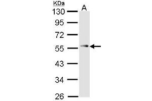 Image no. 1 for anti-Tumor Protein P53 (TP53) (AA 312-374) antibody (ABIN467631) (p53 antibody  (AA 312-374))