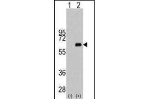 Western blot analysis of MYC (arrow) using rabbit polyclonal MYC Antibody  (ABIN388720 and ABIN2838829). (c-MYC antibody  (AA 351-380))