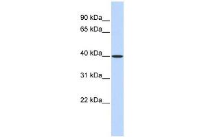 MAT2B antibody used at 1 ug/ml to detect target protein. (MAT2B antibody  (Middle Region))