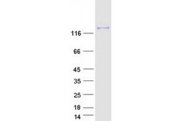 Hephaestin Protein (HEPH) (Transcript Variant 2) (Myc-DYKDDDDK Tag)