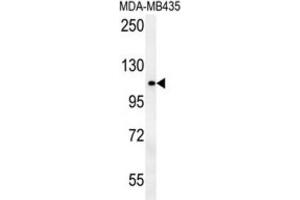 Western Blotting (WB) image for anti-OTU Domain Containing 4 (OTUD4) antibody (ABIN3002507) (OTUD4 antibody)