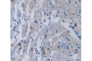 IHC-P analysis of heart tissue, with DAB staining. (TOP3B antibody  (AA 1-250))