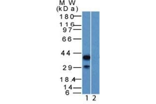 p63 antibody  (AA 5-17)