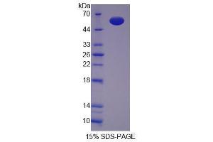 Image no. 1 for Huntingtin Associated Protein 1 (HAP1) (AA 349-584) protein (His tag,GST tag) (ABIN4990754) (HAP1 Protein (AA 349-584) (His tag,GST tag))