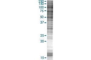 LYSMD2 transfected lysate. (LYSMD2 293T Cell Transient Overexpression Lysate(Denatured))