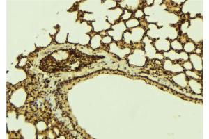 ABIN6273203 at 1/100 staining Mouse lung tissue by IHC-P. (C14orf166 antibody)