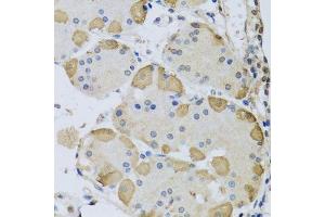 Immunohistochemistry of paraffin-embedded human stomach using ANAPC10 antibody. (ANAPC10 antibody  (AA 1-185))