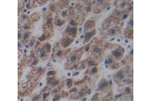 IHC-P analysis of Human Tissue, with DAB staining. (STING/TMEM173 antibody  (AA 159-373))