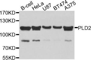 Western blot analysis of extracts of various cells, using PLD2 antibody. (Phospholipase D2 antibody)