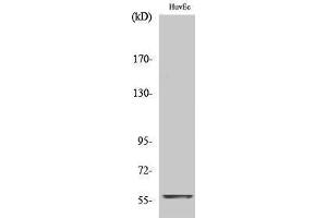 Western Blotting (WB) image for anti-Myc Proto-Oncogene protein (MYC) (C-Term) antibody (ABIN3183980) (c-MYC antibody  (C-Term))