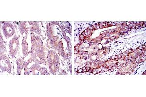 Immunohistochemistry (IHC) image for anti-Eukaryotic Translation Initiation Factor 4E (EIF4E) antibody (ABIN969094)