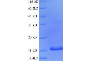 SDS-PAGE (SDS) image for CCAAT/enhancer Binding Protein (C/EBP), gamma (CEBPG) (AA 1-148), (partial) protein (His tag) (ABIN5712866) (CEBPG Protein (AA 1-148, partial) (His tag))