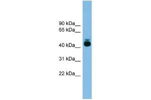 GPR87 antibody used at 1 ug/ml to detect target protein. (GPR87 antibody  (Middle Region))