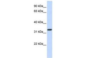 Image no. 1 for anti-NK2 Homeobox 5 (NKX2-5) (AA 72-121) antibody (ABIN6742220) (NK2 Homeobox 5 antibody  (AA 72-121))