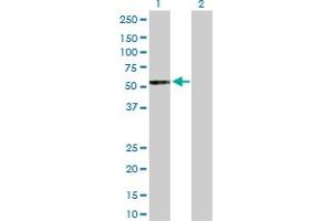 Western Blot analysis of UGT2B15 expression in transfected 293T cell line by UGT2B15 MaxPab polyclonal antibody. (UGT2B15 antibody  (AA 1-530))