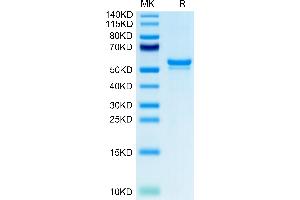 CA9 Protein (AA 38-414) (His-Avi Tag)