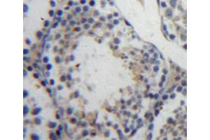 Used in DAB staining on fromalin fixed paraffin-embedded testis tissue (Ubiquitin Hydrolase L3 (AA 2-230) antibody)