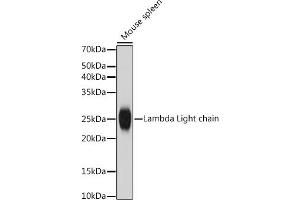 Western blot analysis of extracts of Mouse spleen, using Lambda Light chain antibody (ABIN7267847) at 1:1000 dilution. (IGLV1-51 antibody)