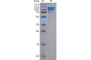 APP Protein (AA 18-669) (His tag)