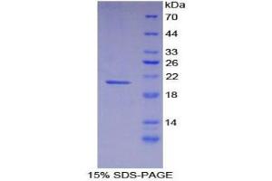 SDS-PAGE (SDS) image for Fibrillin 1 (FBN1) (AA 457-634) protein (His tag) (ABIN1879758) (Fibrillin 1 Protein (FBN1) (AA 457-634) (His tag))