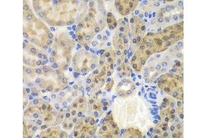 Immunohistochemistry of paraffin-embedded Mouse kidney using AKR1A1 Polyclonal Antibody at dilution of 1:100 (40x lens). (AKR1A1 antibody)