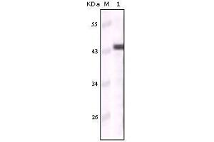 Western Blot showing CK5 antibody used against truncated CK5 recombinant protein (Cytokeratin 5 antibody)