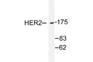 Image no. 1 for anti-Receptor tyrosine-protein kinase erbB-2 (ErbB2/Her2) antibody (ABIN265462) (ErbB2/Her2 antibody)