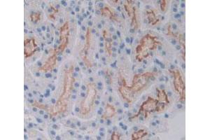 IHC-P analysis of Rat Kidney Tissue, with DAB staining. (VEGFR2/CD309 antibody  (AA 46-320))