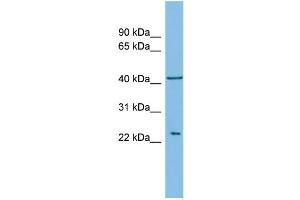 WB Suggested Anti-RALB Antibody Titration: 0. (RALB antibody  (Middle Region))