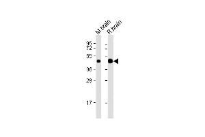 All lanes : Anti-CNP Antibody (N-Term) at 1:2000 dilution Lane 1: mouse brain lysates Lane 2: rat brain lysates Lysates/proteins at 20 μg per lane. (Cnpase antibody  (AA 92-126))