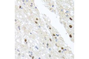 Immunohistochemistry of paraffin-embedded rat brain using YTHDF3 antibody (ABIN5974579) at dilution of 1/100 (40x lens). (YTHDF3 antibody)