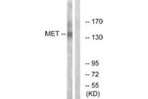 Western blot analysis of extracts from HepG2 cells, using Met (Ab-1349) Antibody. (c-MET antibody  (AA 1316-1365))