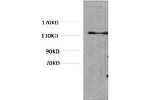 Western blot analysis of Hela, diluted at 1:1000. (COL3 antibody)