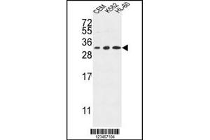 Western blot analysis in CEM,K562,HL-60 cell line lysates (35ug/lane). (Tetraspanin 2 antibody  (AA 109-137))