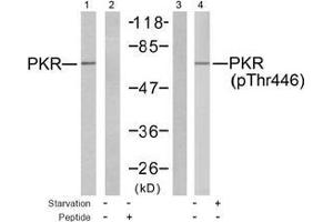 Image no. 2 for anti-Eukaryotic Translation Initiation Factor 2-alpha Kinase 2 (EIF2AK2) (pThr446) antibody (ABIN197049) (EIF2AK2 antibody  (pThr446))