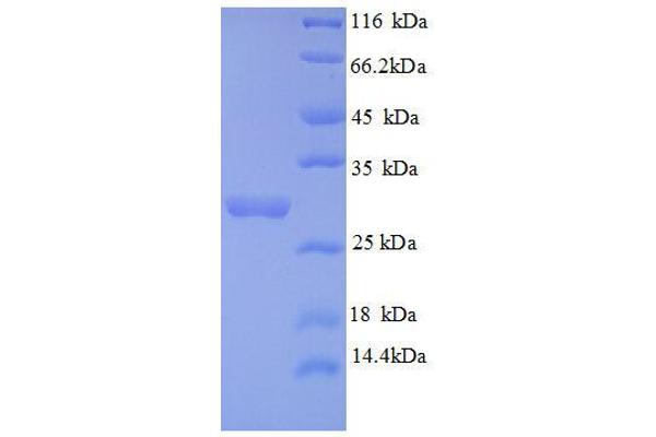 AIG1 Protein (AA 60-87, partial) (GST tag)