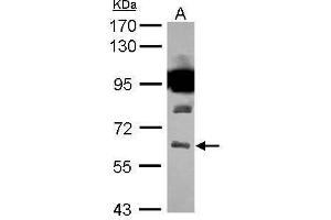 Western Blotting (WB) image for anti-Solute Carrier Family 32 (GABA Vesicular Transporter), Member 1 (SLC32A1) (N-Term) antibody (ABIN2855225)