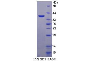 Image no. 1 for Transient Receptor Potential Cation Channel, Subfamily A, Member 1 (TRPA1) (AA 63-370) protein (His tag) (ABIN4990470) (TRPA1 Protein (AA 63-370) (His tag))