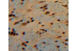 IHC-P analysis of brain tissue, with DAB staining. (CNTF antibody  (AA 2-200))