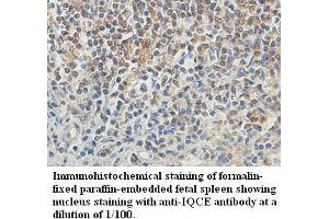 Image no. 1 for anti-IQ Motif Containing E (IQCE) antibody (ABIN1577298) (IQCE antibody)